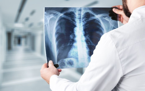 X-Ray